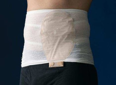 Replant_Convatec_tytex_corsinel_stomasafe_classic_derekov4