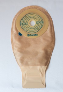 replant_convatec_416718